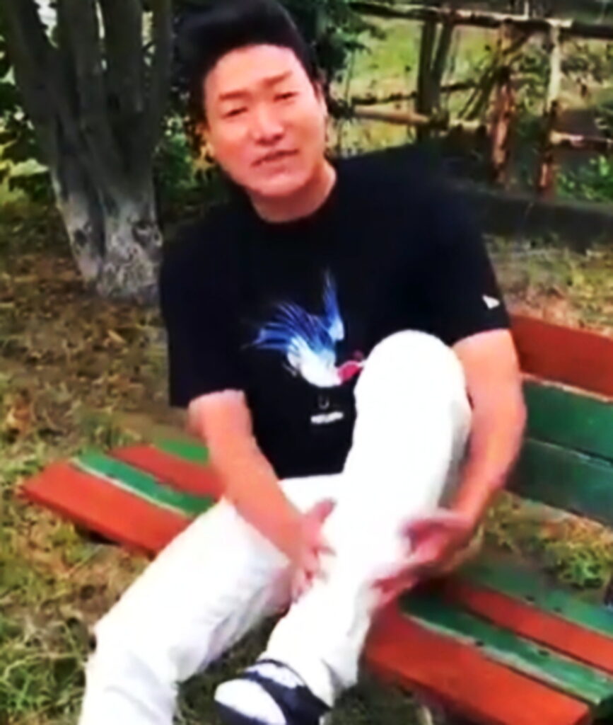 みやぞん イッテQ 骨折 インスタグラムより