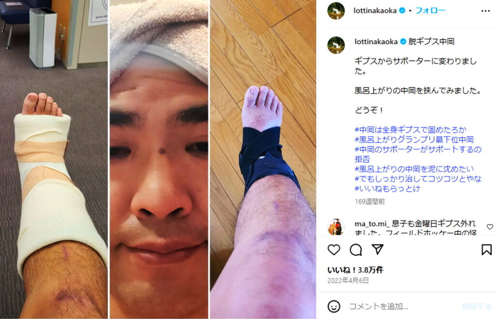 ロッチ中岡 怪我 骨折 2022年 インスタグラムより